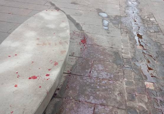 Imola, scia di sangue in centro: uomo ferito all’ospedale