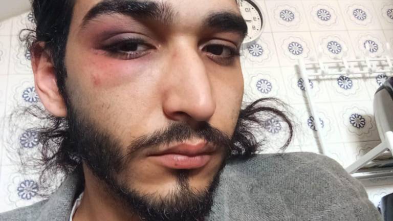 Riccione. Massacrato da una baby gang in piazzale Roma. Il racconto del ragazzo: “Salvato da un carabiniere” Riccione. Massacrato da una baby gang in piazzale Roma. Il racconto del ragazzo: “Salvato da un carabiniere”