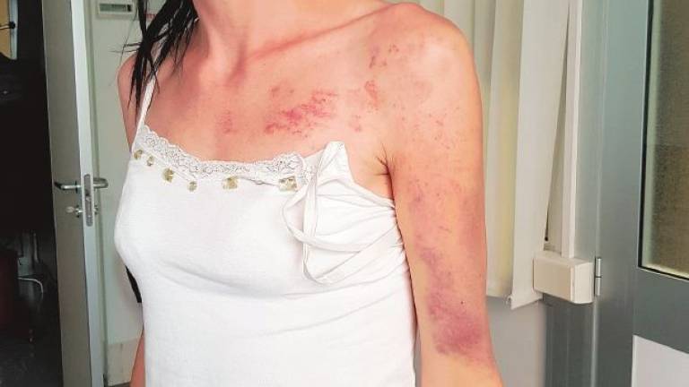 Cesena: botte alla moglie, condanna ridotta in Appello Cesena: botte alla moglie, condanna ridotta in Appello