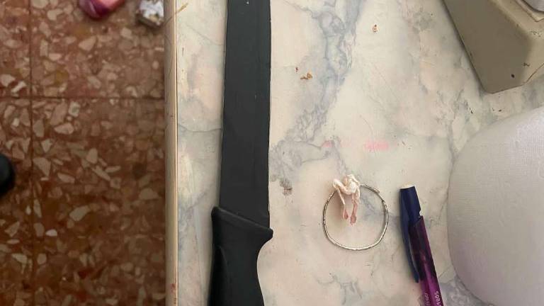 Imola, operata al fegato la 63enne accoltellata dal figlio Imola, operata al fegato la 63enne accoltellata dal figlio