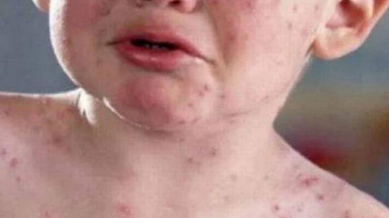 Vaccini, ordinanza del Comune di Rimini: asilo vietato e multe ai genitori Vaccini, ordinanza del Comune di Rimini: asilo vietato e multe ai genitori