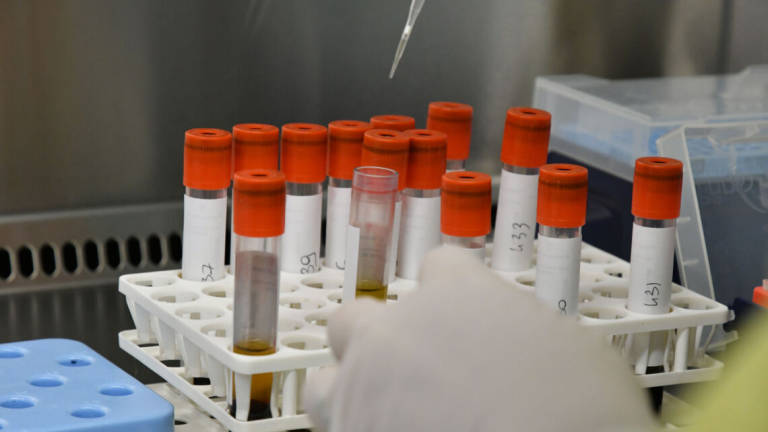 Coronavirus Ravenna, contagi oltre quota 10mila e 4 morti Coronavirus Ravenna, contagi oltre quota 10mila e 4 morti