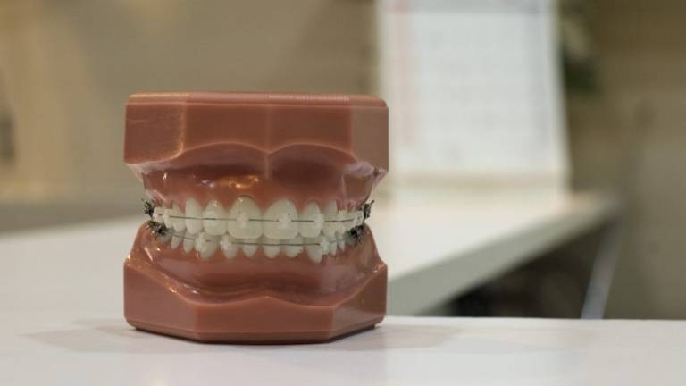 Ortodonzia per adulti: un bel sorriso sano non ha età Ortodonzia per adulti: un bel sorriso sano non ha età