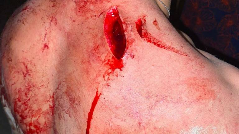 Risse tra bande di giovanissimi: accoltellato e ferito a Cesena col collo rotto di una bottiglia Risse tra bande di giovanissimi: accoltellato e ferito a Cesena col collo rotto di una bottiglia