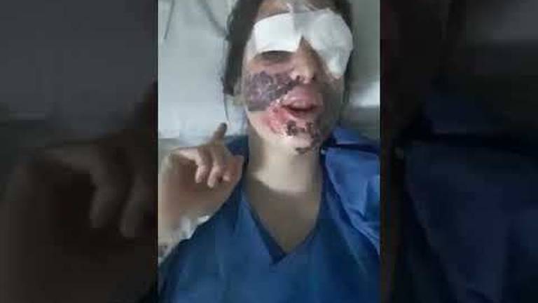 Gessica Notaro si mostra dopo l'intervento: Sono fortunata. VIDEO Gessica Notaro si mostra dopo l'intervento: Sono fortunata. VIDEO