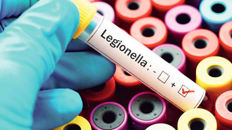Legionella in hotel, albergatore riminese accusato di epidemia colposa Legionella in hotel, albergatore riminese accusato di epidemia colposa