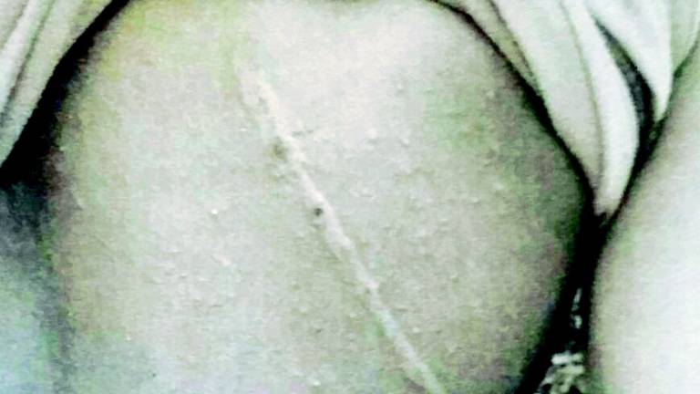 Vetturino frusta un ragazzino in scooter Vetturino frusta un ragazzino in scooter