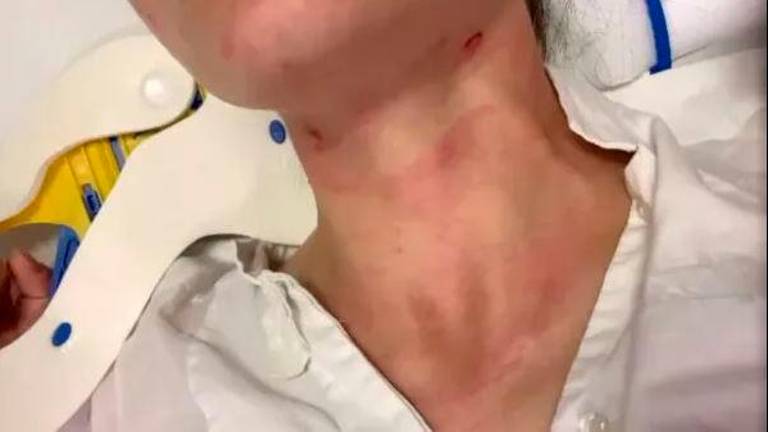 I periti dovranno comparare i segni sul collo della donna e un laccio sequestrato I periti dovranno comparare i segni sul collo della donna e un laccio sequestrato