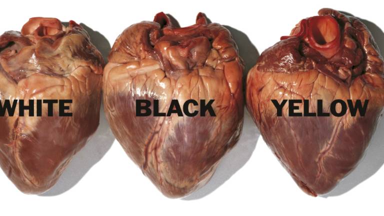 Bologna, Oliviero Toscani in mostra a Palazzo Albergati Bologna, Oliviero Toscani in mostra a Palazzo Albergati