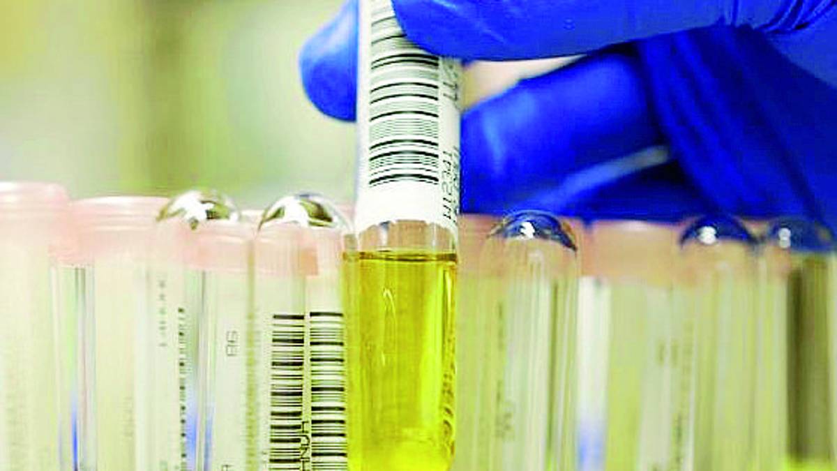 Rimini,scambiata la pipì da analizzare: medico e infermiera a processo