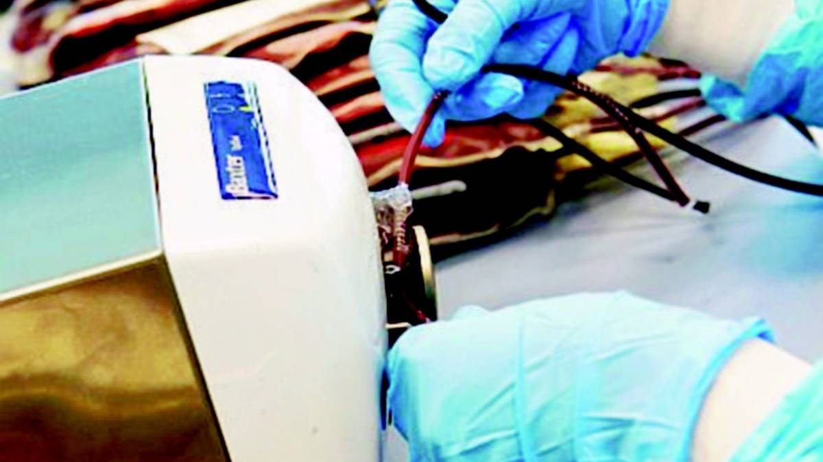 Donazione di sangue: appello dell'Ausl prima di partire per le vacanze