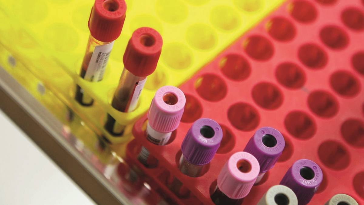 Hiv, aumenta la positività tra le donne della Romagna