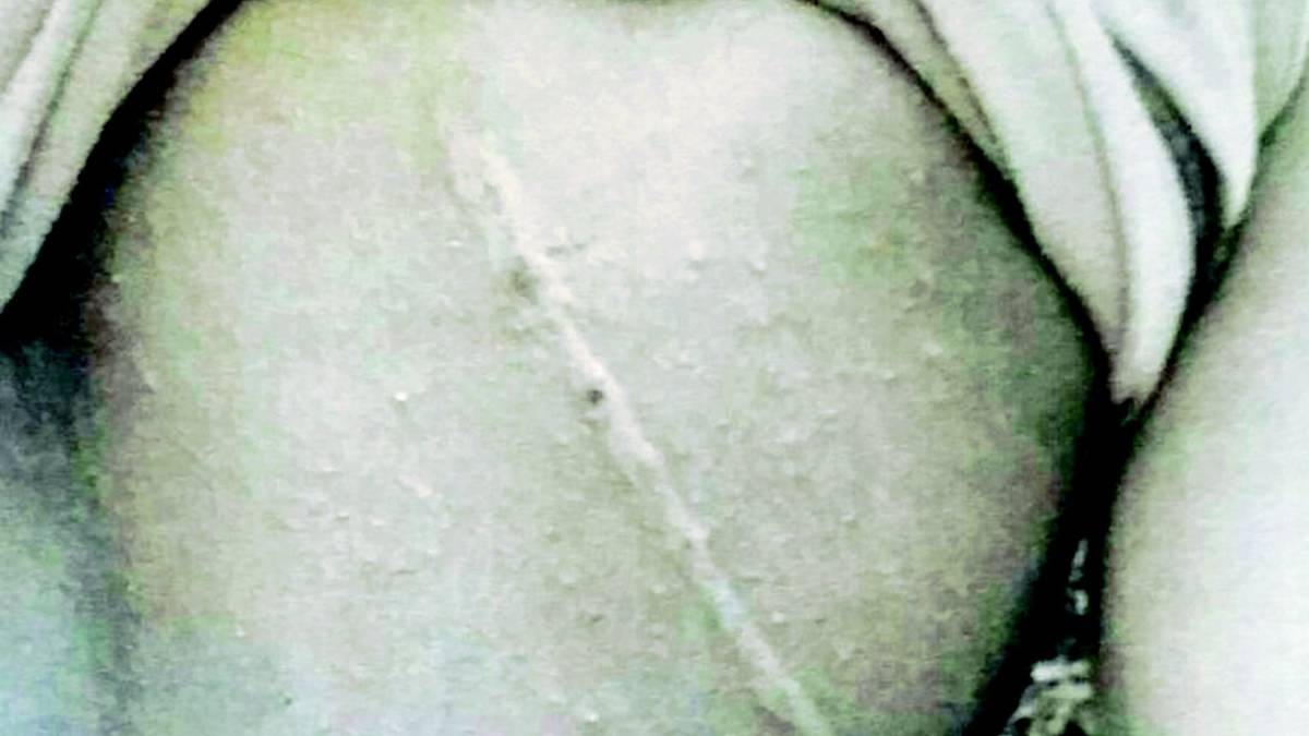 Vetturino frusta un ragazzino in scooter