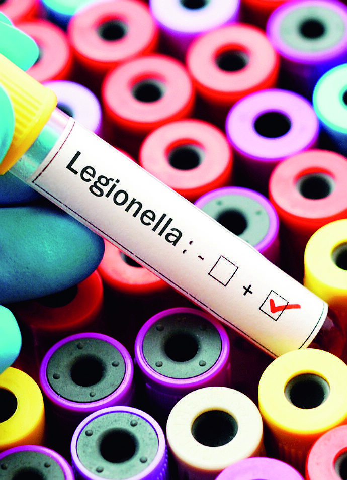 San Marino, legionella all'ospedale. Tracce nei tubi dell'acqua calda