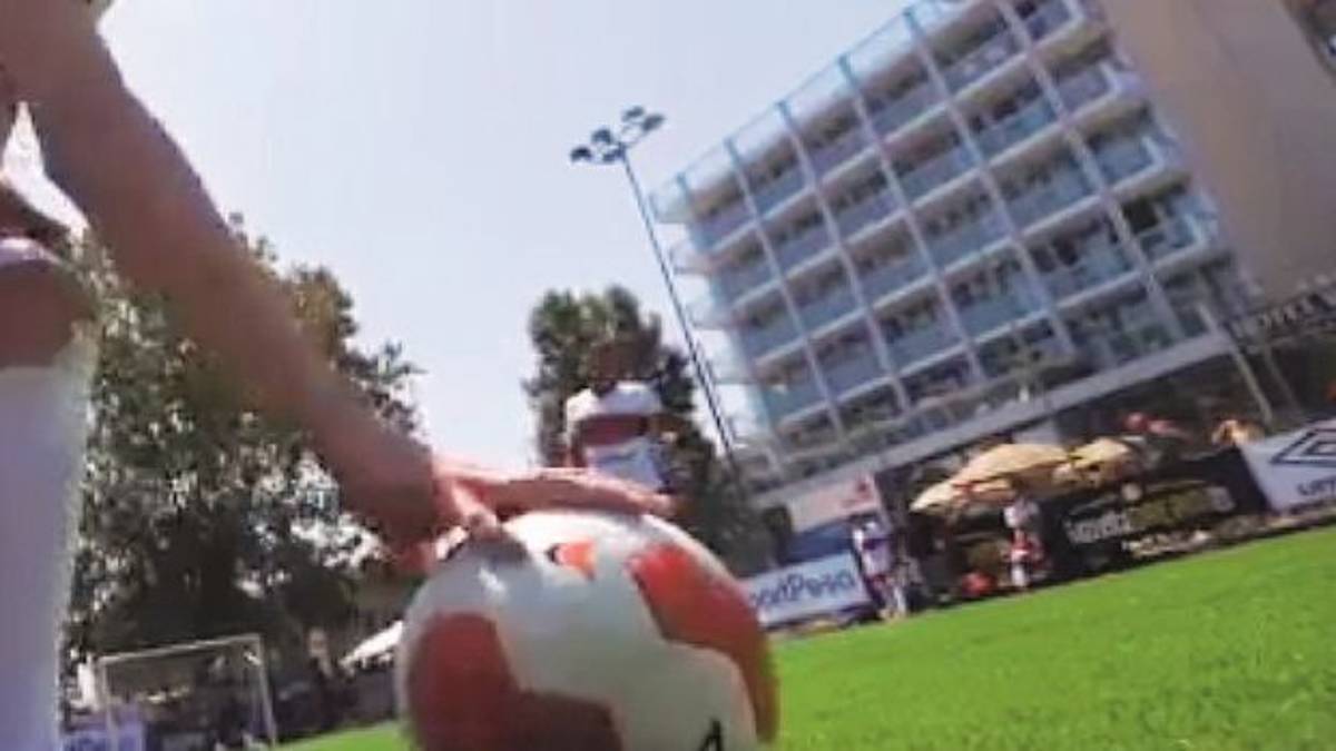 Sediate in testa e braccio spaccato, esplode l’inferno alla partita di calcio