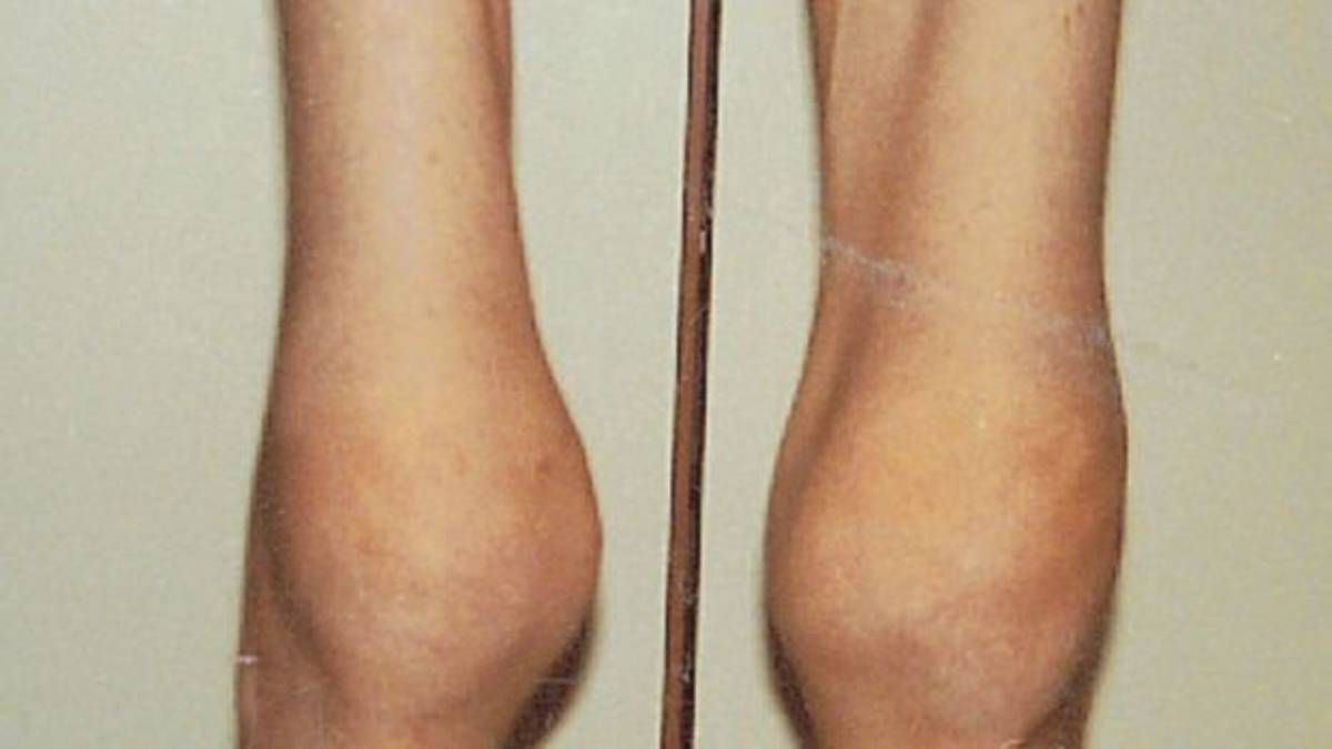 Scoperta psico setta macrobiotica. Diete ferree, adepti ridotti in schiavitù
