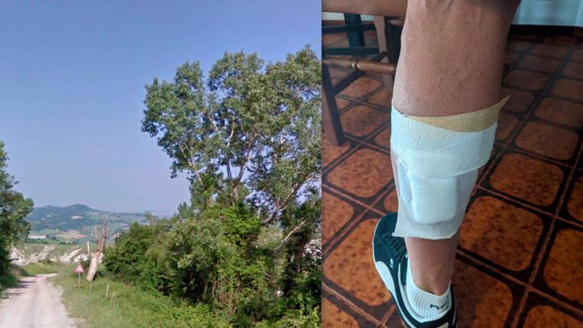 La via Monteboso tra Bivio Montegelli e Montegelli e la gamba ferita del ciclista