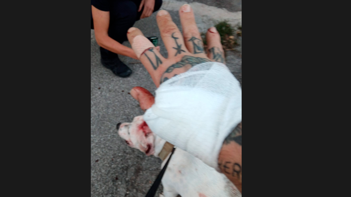 Lugo, porta a passeggio la sua pitbull e vengono aggrediti da altri due cani