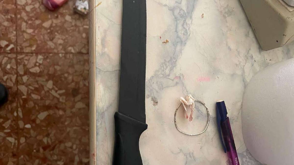 Imola, operata al fegato la 63enne accoltellata dal figlio