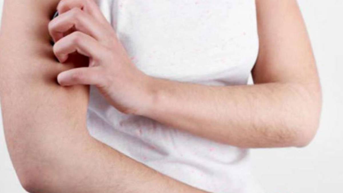 Alunno con la scabbia: bonificata un'elementare a Cesena