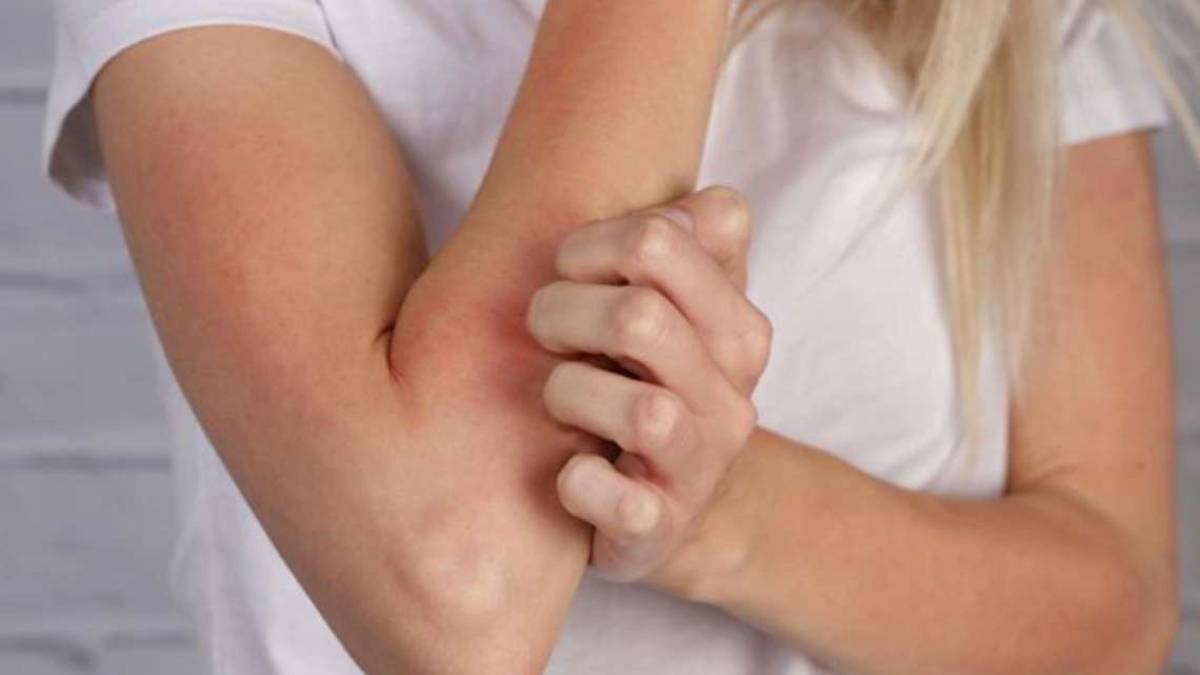 La salute comincia in superficie: problemi della pelle e freddo