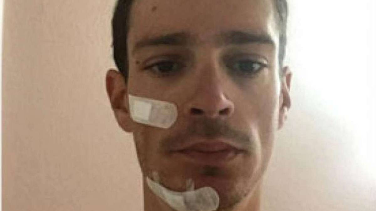 Scontro in allenamento a Savignano: ferito Manuel Senni
