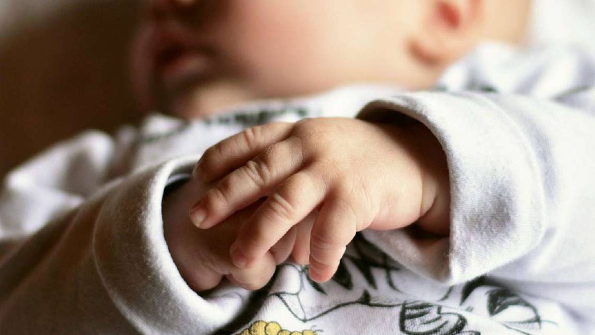 Labbro leporino: la malformazione che colpisce un neonato su mille