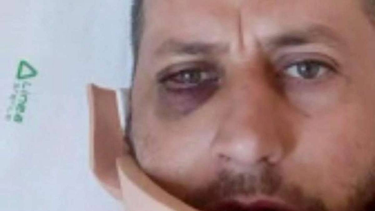 Rimini. Massacrato di botte davanti a un bar. Chi ha visto parli