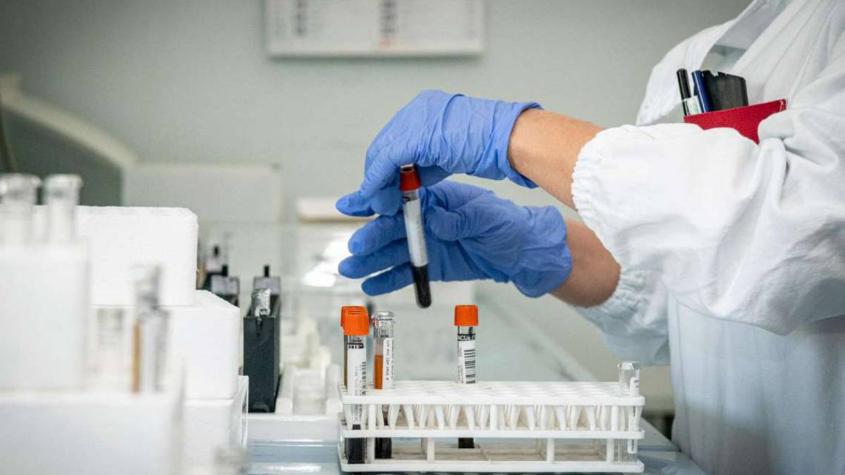 Covid, la tempesta perfetta che porta alla trombosi
