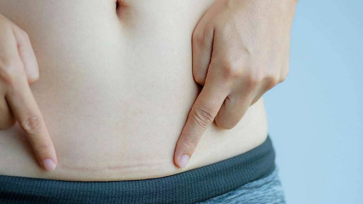 Isteroscopia, uno sguardo profondo al centro riproduttivo femminile