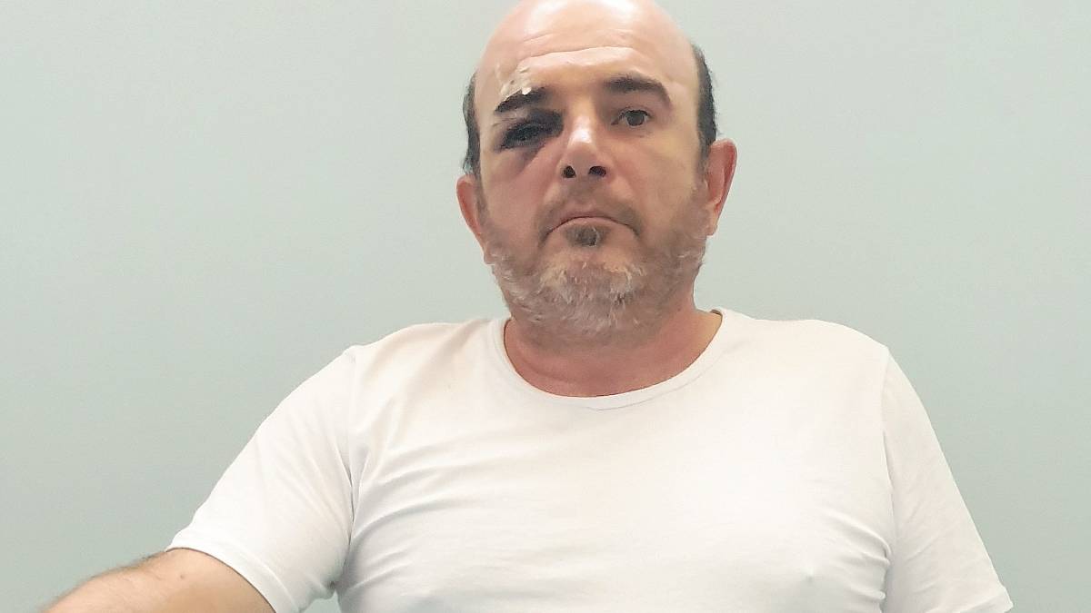 Rimini, portiere di notte aggredito e picchiato