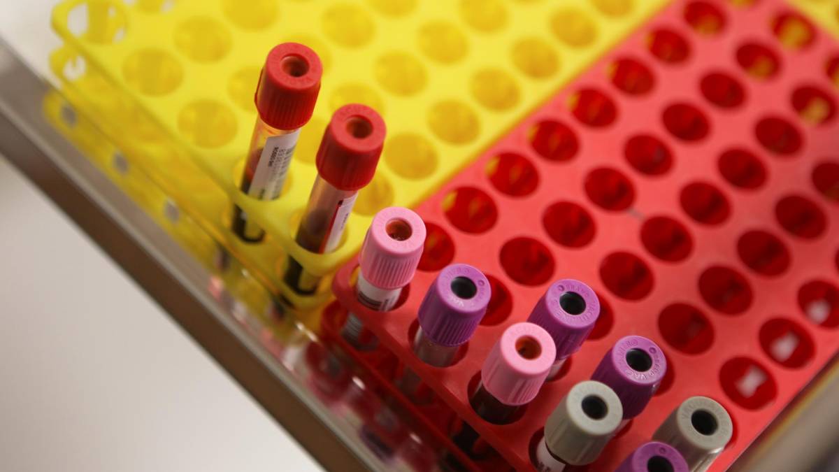 Scambio delle urine in provetta: medico e infermiera a processo in Cassazione
