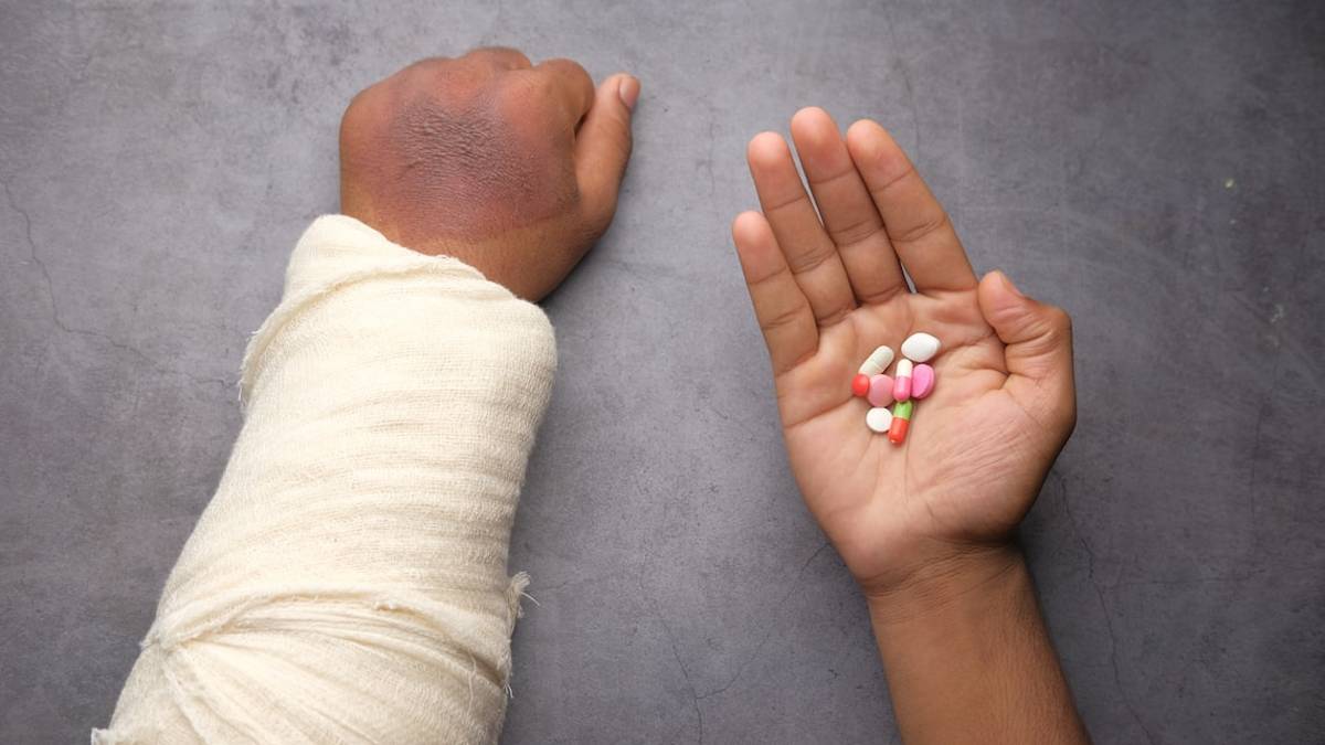 Rimini, ruba al ristorante e in albergo con la mano ingessata: arrestato insieme al complice