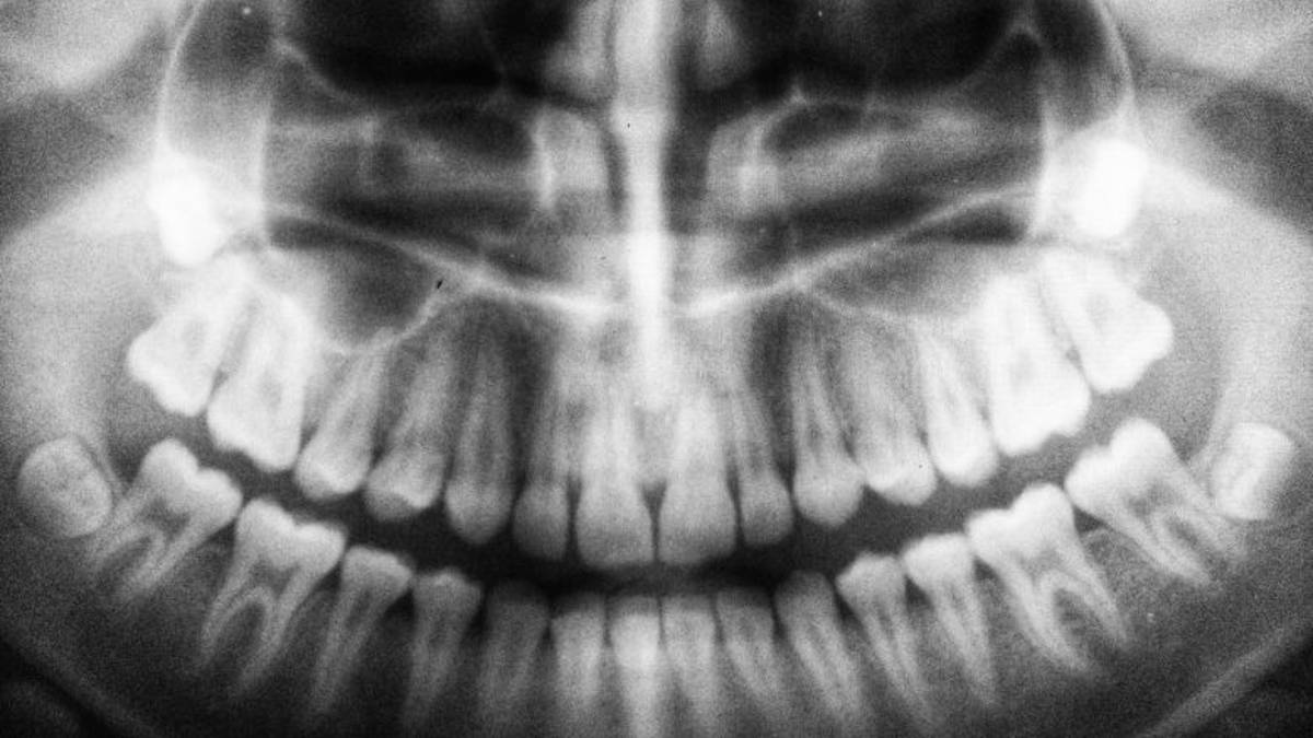 Imola, sconosciuto al Fisco gestiva viaggi per curare denti in Croazia