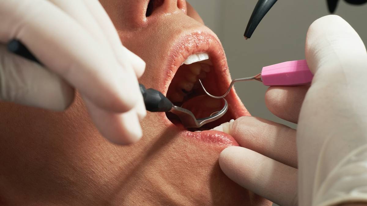 Caso Dentix: accordo tra UgCons Romagna e Cofidis