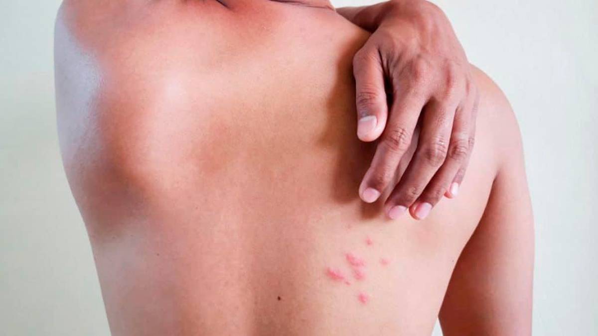 Ma il vaccino è gratis solo per i fragili