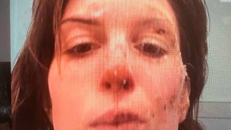 Rogo di Crans-Montana, la famiglia di Eleonora Palmieri: “Arrivata fattura da 17mila franchi svizzeri per 12 ore in ospedale a Sion, è vergognoso”