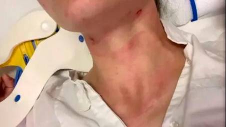 I periti dovranno comparare i segni sul collo della donna e un laccio sequestrato