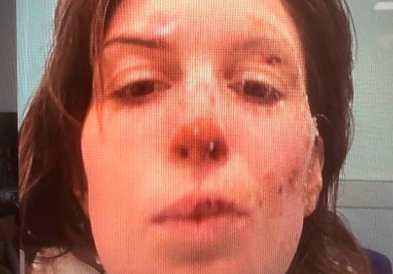 Incendio di Crans-Montana, la forza di Eleonora Palmieri: “Non smettete mai di onorare la vita”