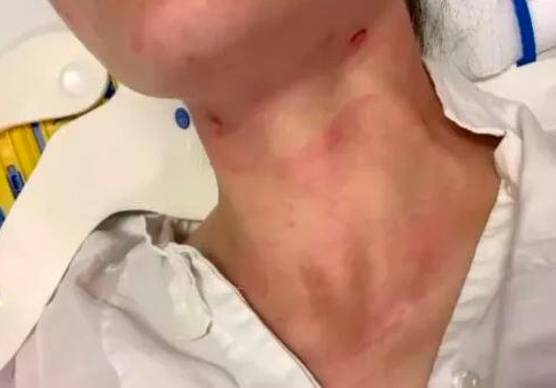 I periti dovranno comparare i segni sul collo della donna e un laccio sequestrato