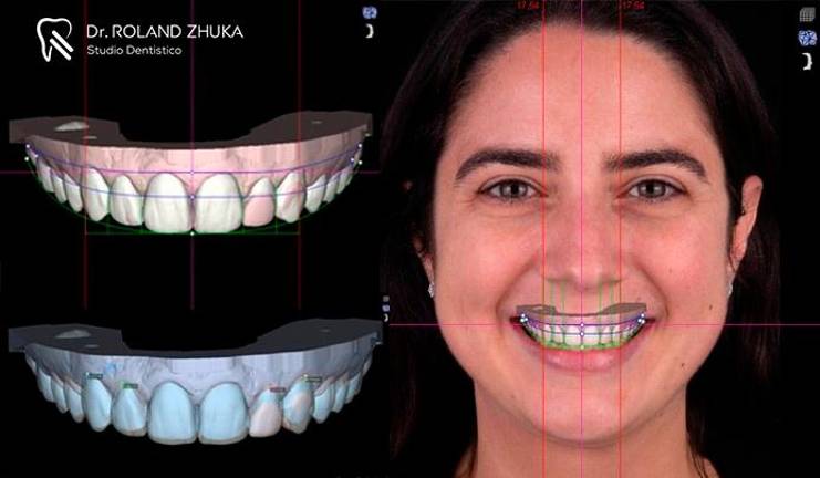 #getAltImage_v1($tempImage)