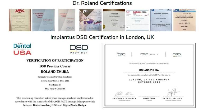 #getAltImage_v1($tempImage)