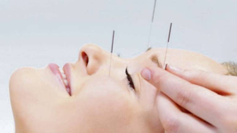 Prevenzione e dolore: agopuntura efficace