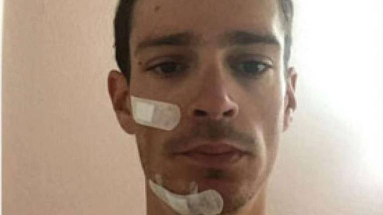 Scontro in allenamento a Savignano: ferito Manuel Senni