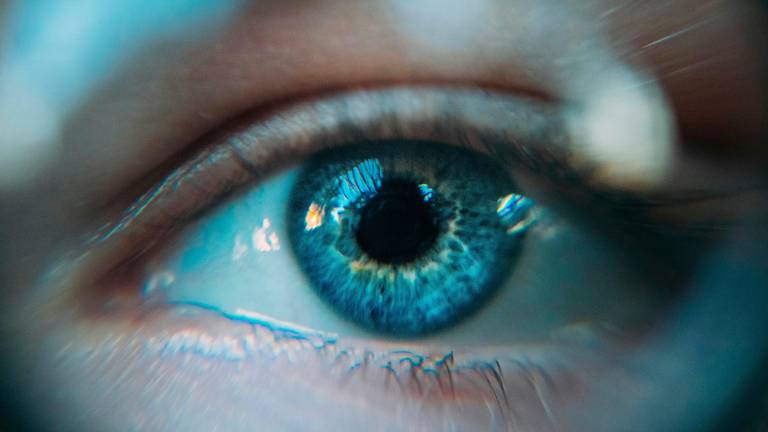 Laser per la miopia e secchezza oculare: cause, durata e rimedi