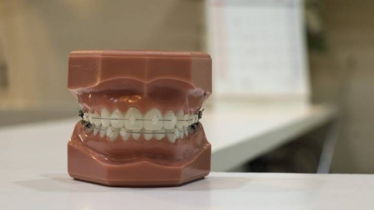 Ortodonzia per adulti: un bel sorriso sano non ha età