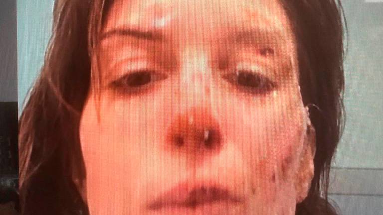 Rogo di Crans-Montana, la famiglia di Eleonora Palmieri: “Arrivata fattura da 17mila franchi svizzeri per 12 ore in ospedale a Sion, è vergognoso”