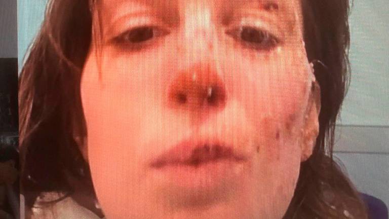 Incendio di Crans-Montana, la forza di Eleonora Palmieri: “Non smettete mai di onorare la vita”