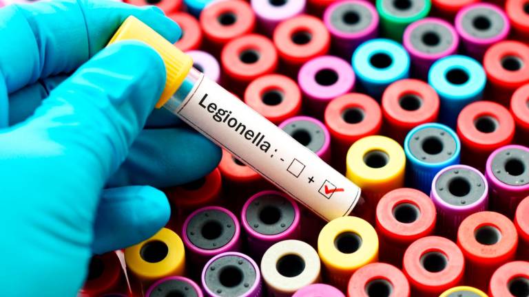 Rimini. Legionella al ritorno dal viaggio da Cuba: turista perde la causa da 565mila euro