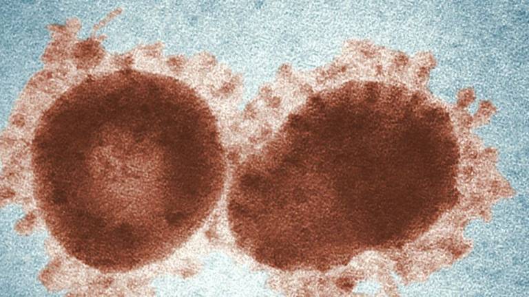A Ravenna scomparse da settimane le polmoniti da coronavirus